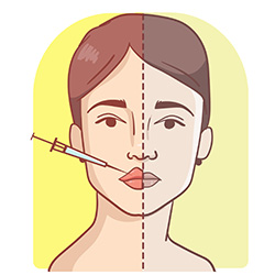 Lip Filler Treatment